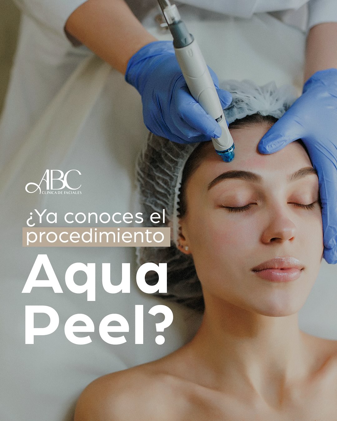 AQUAPEEL