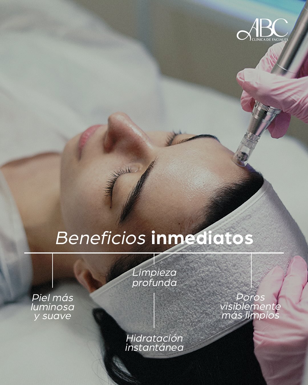 BENEFICIOS