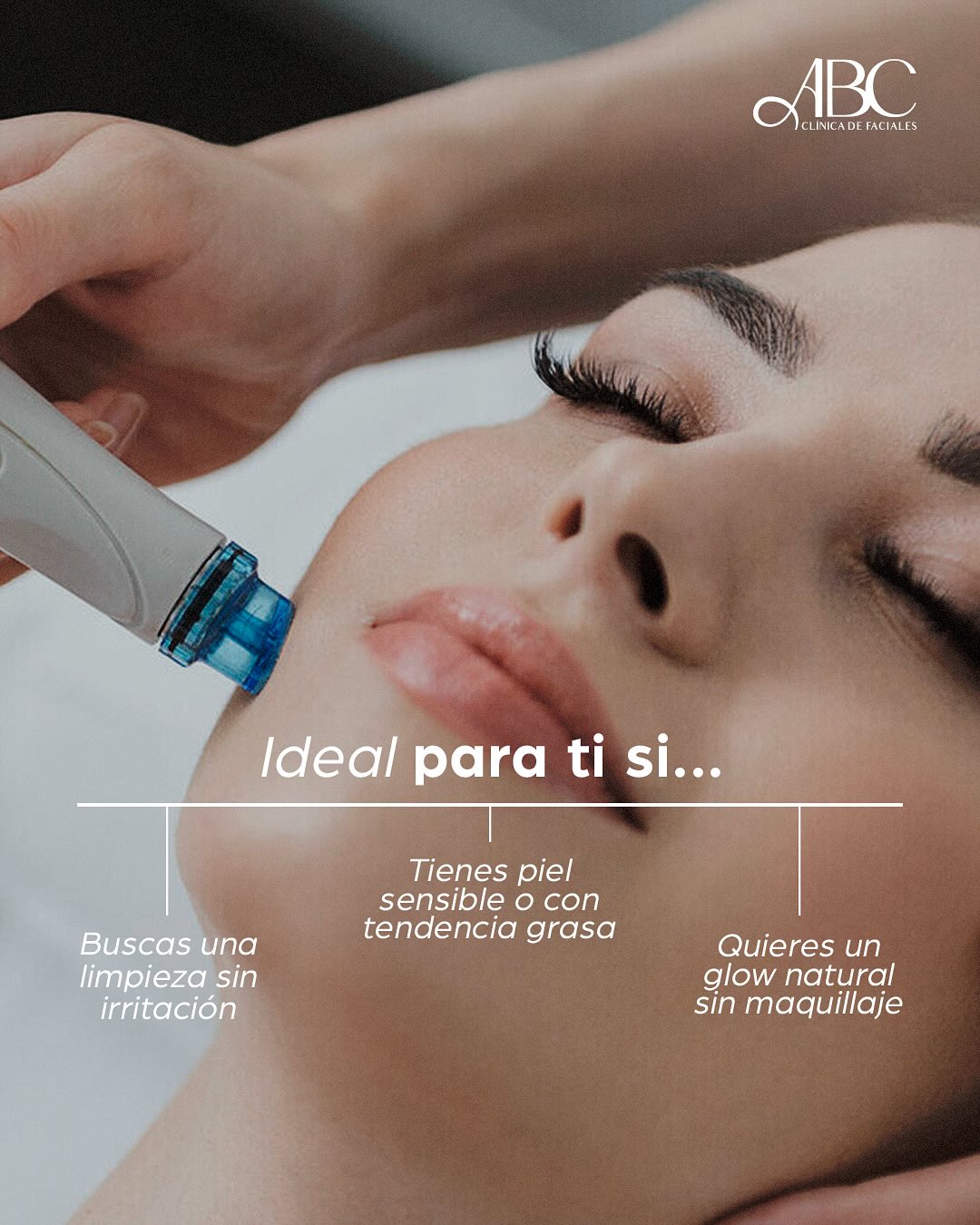 IDEAL